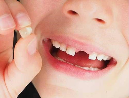 رسم افتادن دندان در کشورهای مختلف, سنت های افتادن دندان کودکان, رسم افتادن دندان در یونان