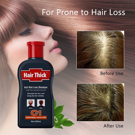 تاثیر شامپوهای ریزش مو, درمان ریزش مو با شامپوهای ضد ریزش مو, شامپوهایی که باعث ریزش مو