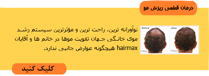 درمان ریزش مو،درمان قطعی ریزش مو،راههای درمان ریزش مو درمان ریزش مو,درمان قطعی ریزش مو,راههای درمان ریزش مو