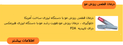 درمان ریزش مو،درمان قطعی ریزش مو،راههای درمان ریزش مو درمان ریزش مو,درمان قطعی ریزش مو,راههای درمان ریزش مو