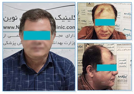 کلینیک پوست و مو ایران نوین کاشت مو,کلینیک پوست و مو,جشنواره کلینیک پوست و مو ایران نوین