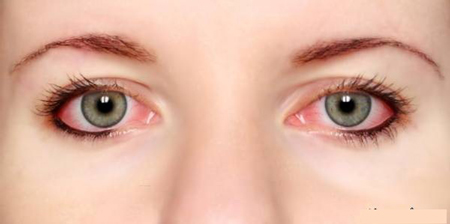 آرایش چشمهای حساس,آرایش چشم حساس,نکاتی کلیدی برای آرایش چشم حساس