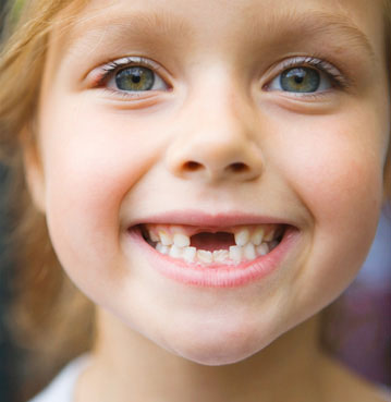 مشکلات دندان کودک,دندان های شیری کودک
