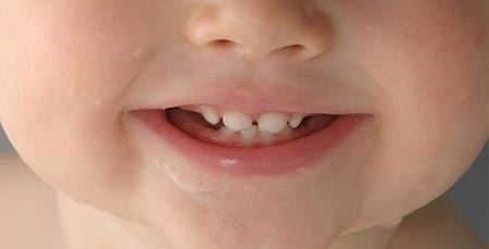 دندان درآوردن نوزادان,علائم دندان درآوردن نوزادان,نشانه های دندان درآوردن نوزادان