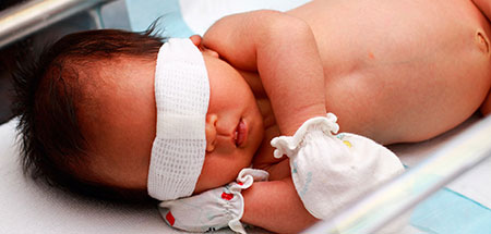 زردی نوزادان,راههای تشخیص زردی نوزادان,روش درمان زردی نوزادان