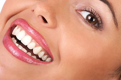زیبایی دندان با این روش ها