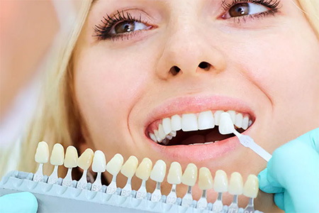 طول عمر کامپوزیت دندان, روش‌های جداسازی ونیر کامپوزیت, دلایل برداشتن کامپوزیت