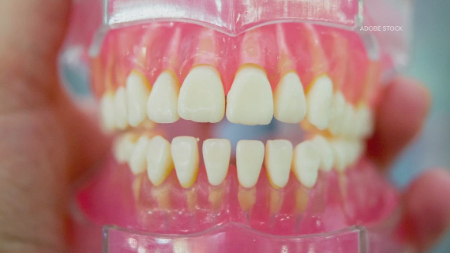 کاشت دندان با سلول های بنیادی, ترمیم دندان با سلول های بنیادی