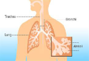 بیماری برونشکتازی چیست؟ 1