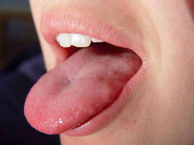 درمان مزه بد دهان , دلایل مزه بد دهان