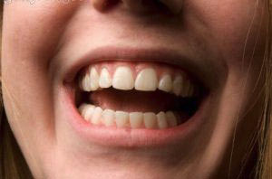 دندان های,دهان ودندان,بهداشت دهان و دندان,روش مسواک زدن