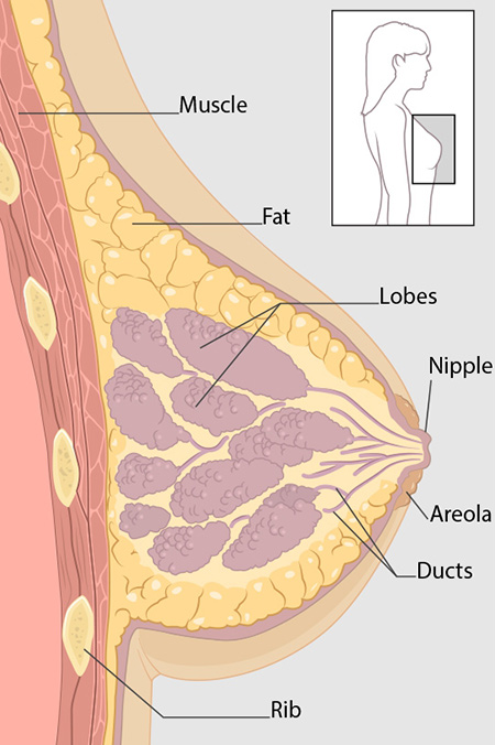 سرطان سینه,سینه زن,کوچک کردن سینه