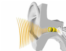 کاهش شنوایی,پیشگیری از افت شنوایی,جلوگیری از افت شنوایی