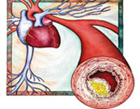 کلسترول,انواع کلسترول,روشهای افزایش HDL خون