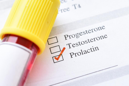,ازمایش پرولاکتین,prolactin در آزمایش خون چیست 