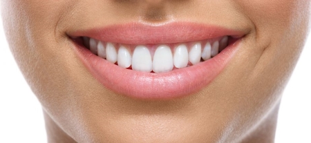 درمان کجی دندان بدون ارتودنسی, صاف کردن دندان کج بدون ارتودنسی, ردیف کردن دندان ها بدون ارتودنسی