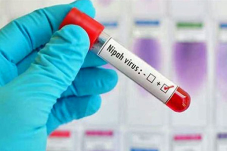 درمان ویروس نیپاه, علایم ویروس نیپاه