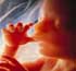 سقط جنين