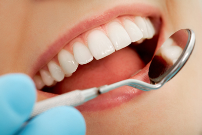 مواد غذایی مفید در پیشگیری از پوسیدگی دندان, پوسیدگى دندان