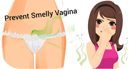 انواع بوی واژن, بوی واژن قبل پریود, بوی شدید یا نامطبوع واژن