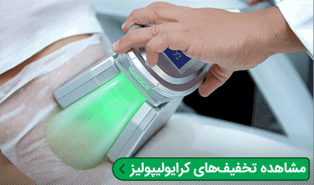 لاغری سریع,دستگاه های لاغری,کرایولیپولیز