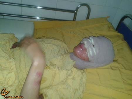 اسیدپاشی,جنایت وحشیانه پدر,جنایت وحشیانه برادر,جنایت هولناک اسیدپاشی,جنایت وحشیانه پدر,جنایت وحشیانه برادر,جنایت هولناک