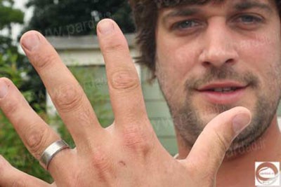 ماجرای حلقه ازدواج خوش شانس,تصاویر خوش شانس ترین حلقه ازدواج