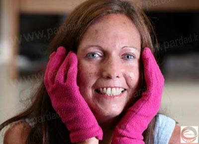 حمام,حمام در وان روغن,بیماریهای عجیب