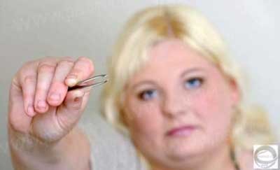 اعتیاد عجیب یک زن جوان به کندن موهای بدنش +تصاویر