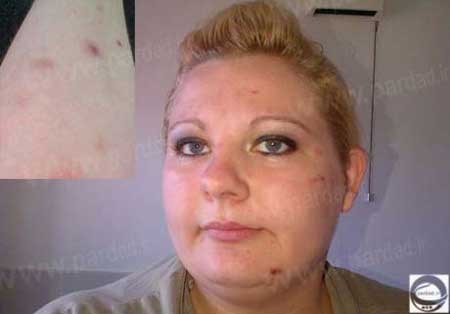 اعتیاد عجیب یک زن جوان به کندن موهای بدنش +تصاویر