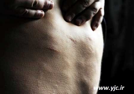 مردی با بدن قطعه قطعه