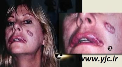 عمل جراحی,عمل جراحی توسط خود بیماران عمل جراحی,عمل جراحی توسط خود بیماران