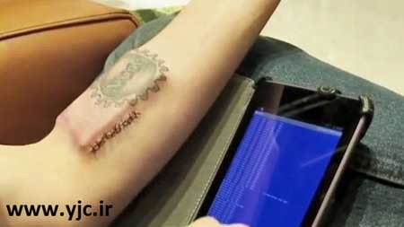 سنسورهای زیر پوستی,استرس,اضطراب