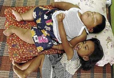 اخبار ,اخبار گوناگون ,چاق ترین بچه