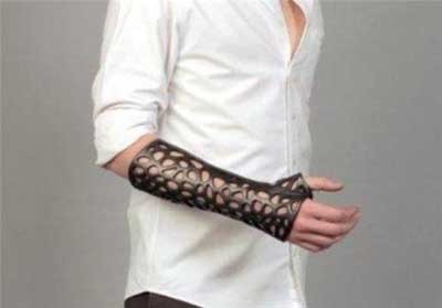 اخبار , اخبار گوناگون,تصاویری از گچ استخوان,تصاویری از جدیدترین گچ های شکستگی اخبار , اخبار گوناگون,تصاویری از گچ استخوان,تصاویری از جدیدترین گچ های شکستگی