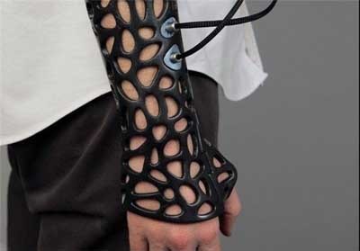 اخبار , اخبار گوناگون,تصاویری از گچ استخوان,تصاویری از جدیدترین گچ های شکستگی اخبار , اخبار گوناگون,تصاویری از گچ استخوان,تصاویری از جدیدترین گچ های شکستگی