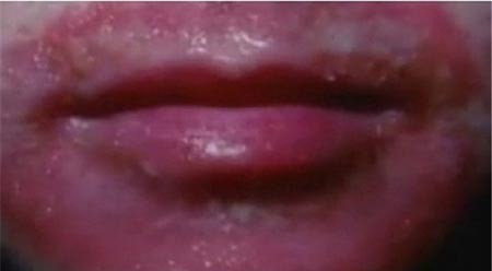 تلفن همراه موجب آلرژی پوستی میشود+تصویر 1
