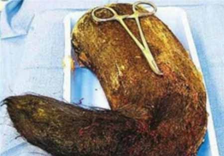 اخبار,اخبار گوناگون,بلعیدن اشیاء به دلایل مختلف