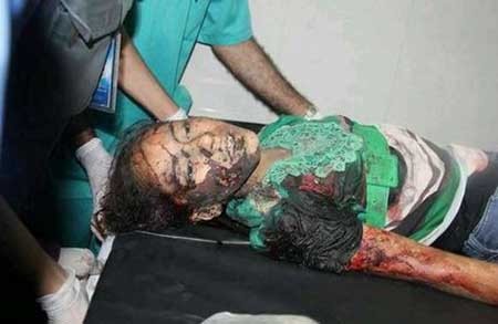 اخبار,اخبار بین الملل ,حملات رژیم صهیونیستی به نوار غزه