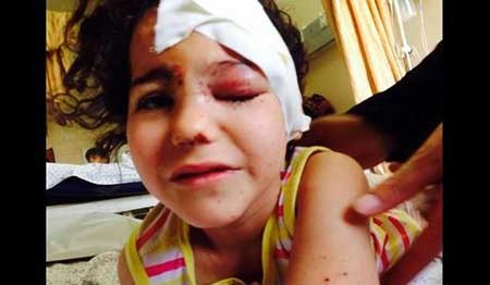 اخبار,اخبار بین الملل ,حملات رژیم صهیونیستی به نوار غزه