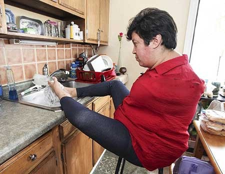 اخبار,اخبار گوناگون ,بیماری خاص