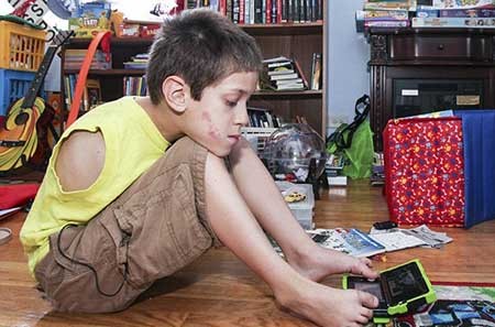 اخبار,اخبار گوناگون ,بیماری خاص