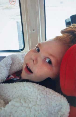 اخبار,اخبار گوناگون ,بیماری های نادر