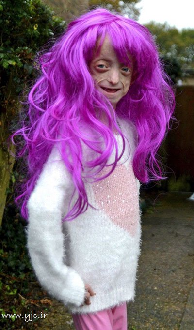 اخبار,اخبارگوناگون,این پیرزن تنها 11 سال سن دارد