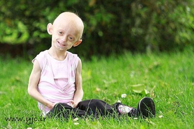 اخبار,اخبارگوناگون,این پیرزن تنها 11 سال سن دارد