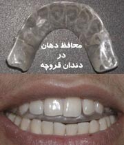 دندان‌قروچ