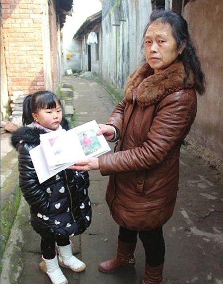 اخبار,اخبار گوناگون,بیماریهای عجیب