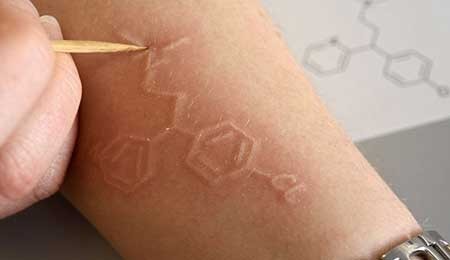 اخبار,اخبار گوناگون , اختلال پوستی