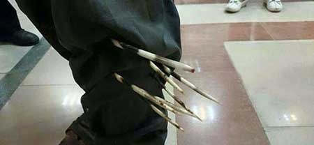 حمله جوجه‌تیغی به کشاورز لرستانی (+عکس) 1