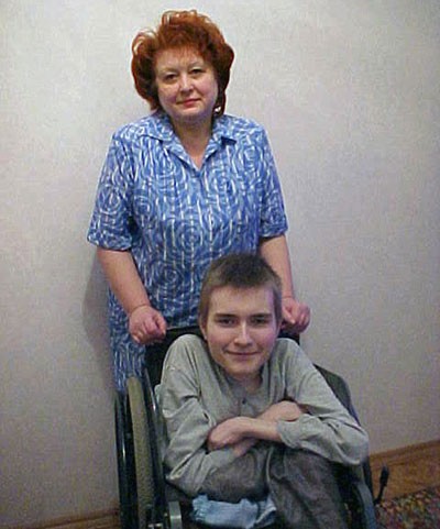 اخبار , اخبار گوناگون, جراحی پیوند سر